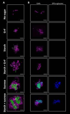 Dietary sugars modulate bacterial-fungal interactions in saliva and inter-kingdom biofilm formation on apatitic surface